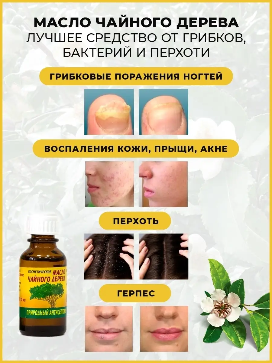 Масло чайного дерева эфирное для ногтей Elfarma 43413729 купить в  интернет-магазине Wildberries