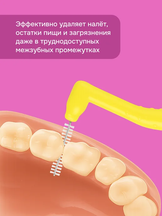 Чистая Защита Medical Набор межзубных ершиков 5 штук для брекетов диаметр 1 мм, 5 шт, фото 2