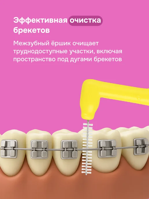 Чистая Защита Medical Набор межзубных ершиков 5 штук для брекетов диаметр 1 мм, 5 шт, фото 4