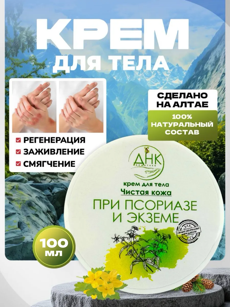Крем для тела при псориазе и дерматите