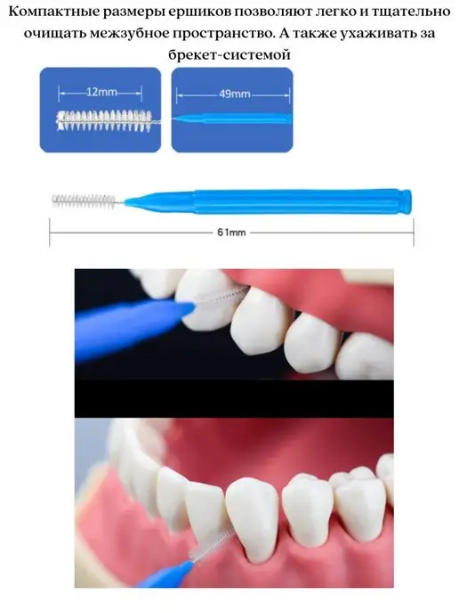 DentaCool Набор межзубных ершиков, вариант, фото 5
