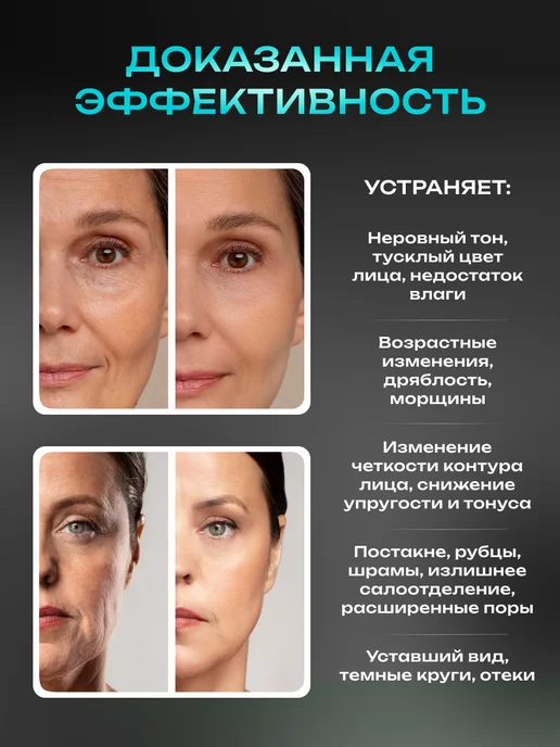 Doctor Comfort Микротоковый массажер для лица RF лифтинг аппарат MC-5, черный, фото 2