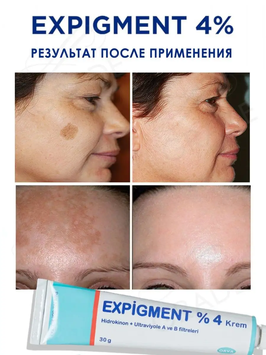 Expigment 4 Купить В Москве