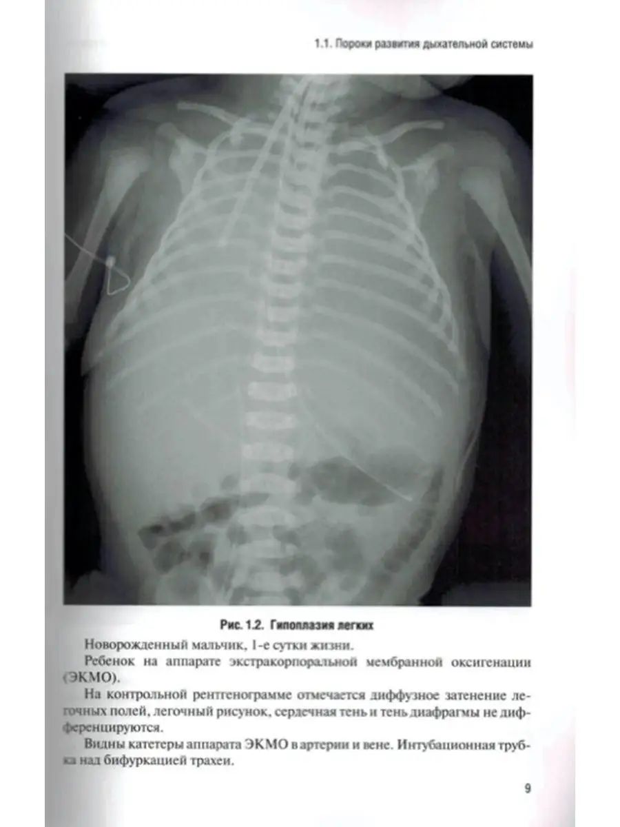 Неотложная рентгенодиагностика в неонато ЭЛБИ-СПб 47136191 купить в  интернет-магазине Wildberries