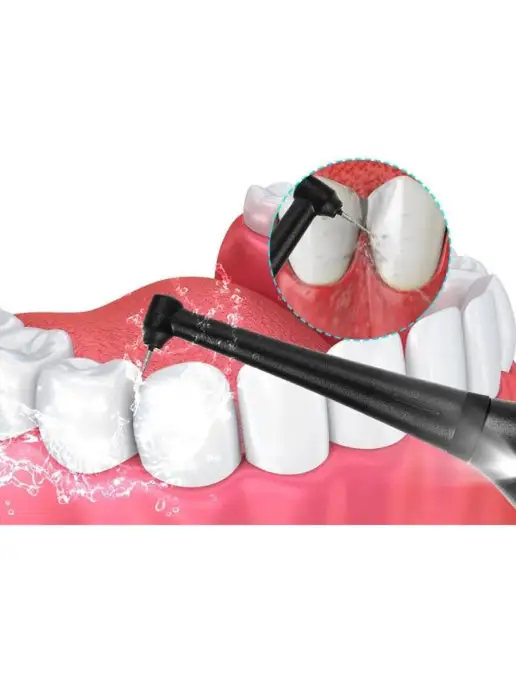 SALE24 Ультразвуковой инструмент для ухода за зубами Dental Tools, черный, фото 4