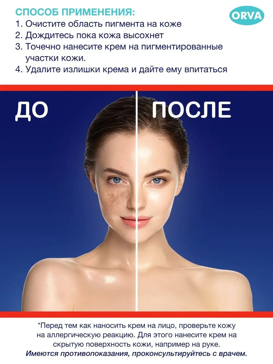 Экспигмент отбеливающий крем для лица Expigment 4% ORVA 48418629 купить в  интернет-магазине Wildberries