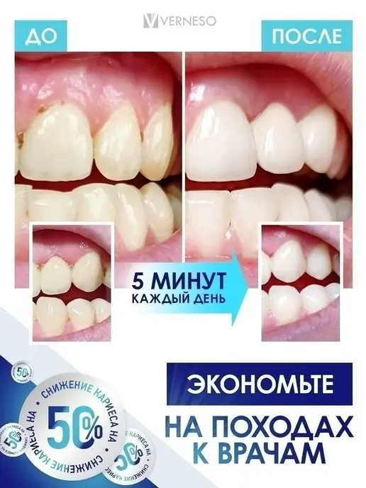 VERNESO Ирригатор для зубов стационарный, белый, фото 7
