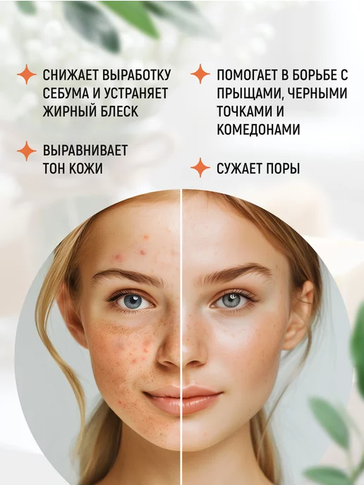 Elibest Мыло с глиной для жирной кожи от прыщей для лица и тела, вариант, фото 2