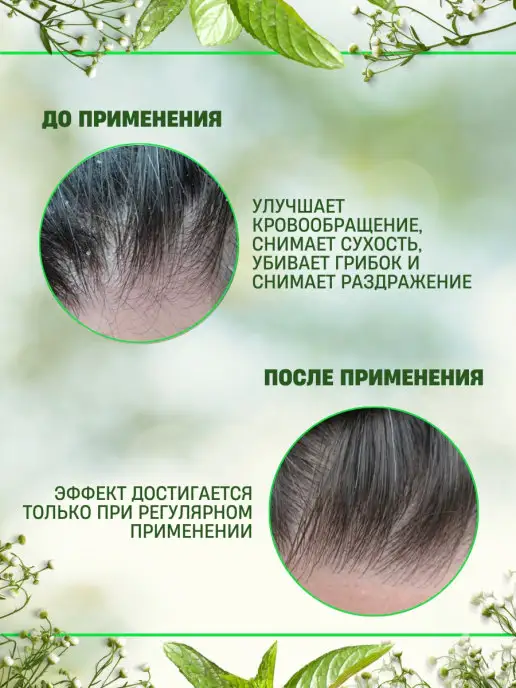 Аромарти Эфирное масло Чайного дерева 10мл, 10 мл, фото 3