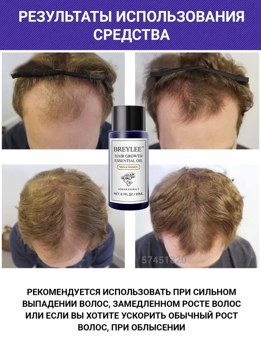 Масло для роста волос BREYLEE Hair Growth Oil ASIAN SHOP 57451820 купить в  интернет-магазине Wildberries