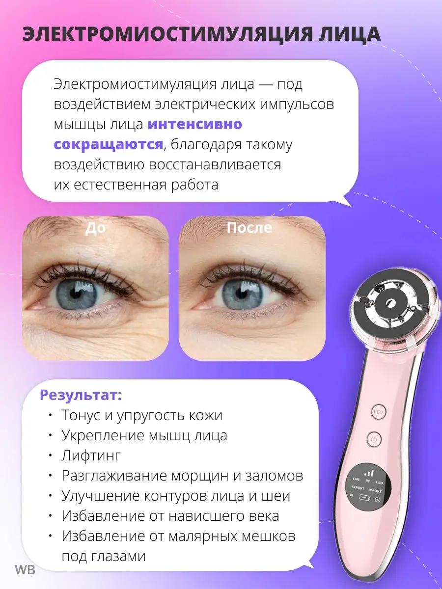 Аппарат для RF лифтинга и мезотерапии, массажер Beauty Lass 59481035 купить  в интернет-магазине Wildberries