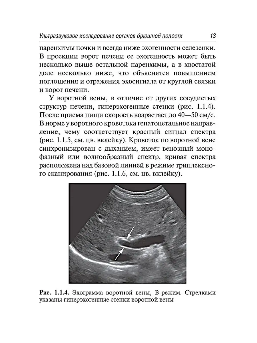 Ультразвуковая диагностика. 3-е изд., испр.и доп ГЭОТАР-Медиа 60472732  купить в интернет-магазине Wildberries