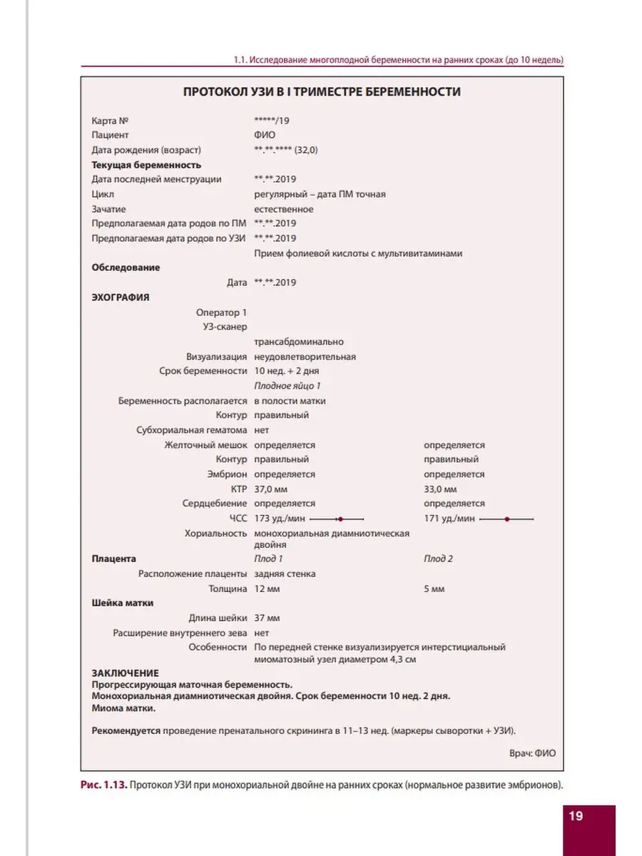 Эхография многоплодной беременности МЕДпресс-информ 61836391 купить за 1  290 ₽ в интернет-магазине Wildberries