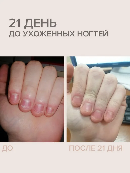 FRENCHI Горький лак для ногтей для детей Грызи не хочу Умная Эмаль, вариант, фото 2