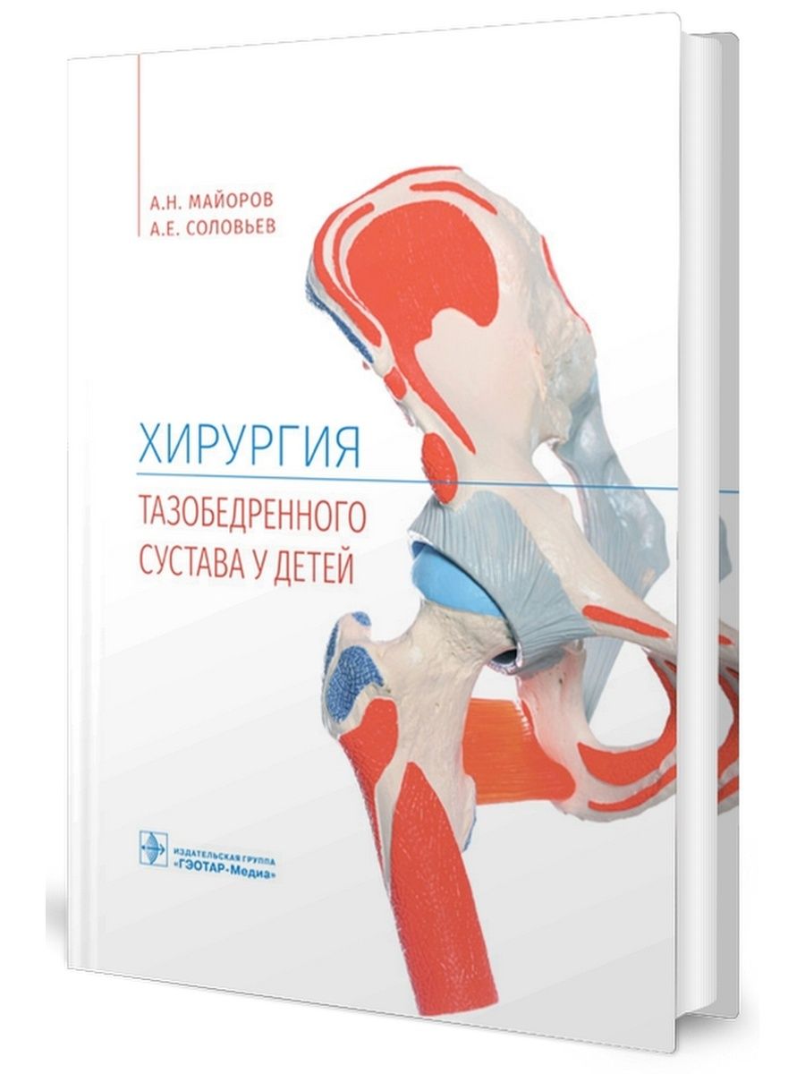 Краснодар операции тазобедренных суставов. Хирургия тазобедренного сустава. Эпифизеолиз лучевого сустава.