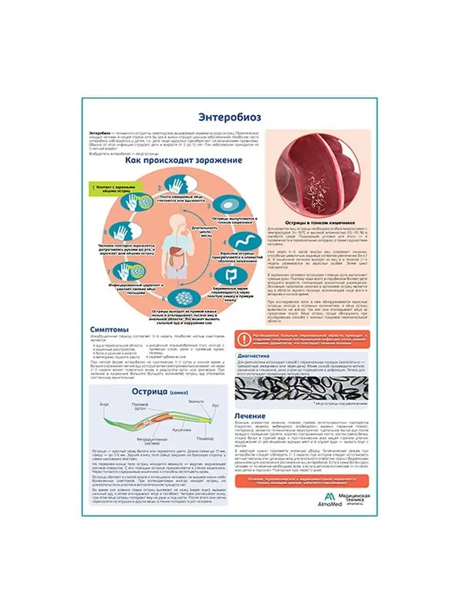 Энтеробиоз (острицы) медицинский плакат Плакаты 63480412 купить за 907 ₽ в  интернет-магазине Wildberries
