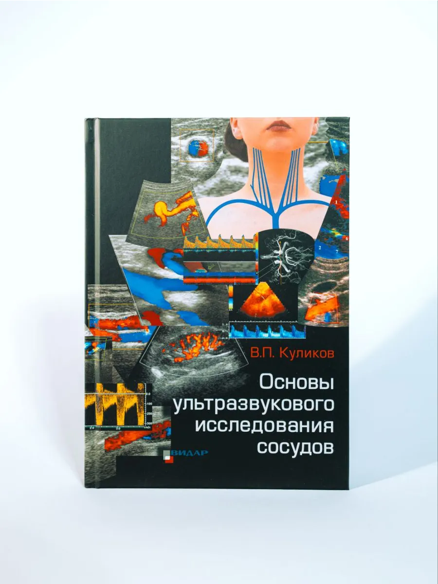 Основы ультразвукового исследования сосудов