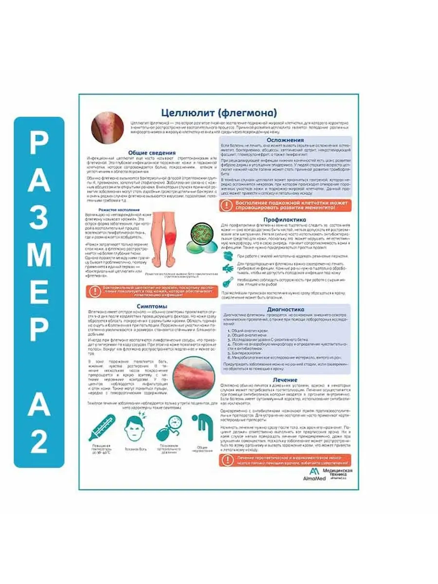 Целлюлит (флегома) медицинский плакат Плакаты 63676424 купить за 836 ₽ в  интернет-магазине Wildberries
