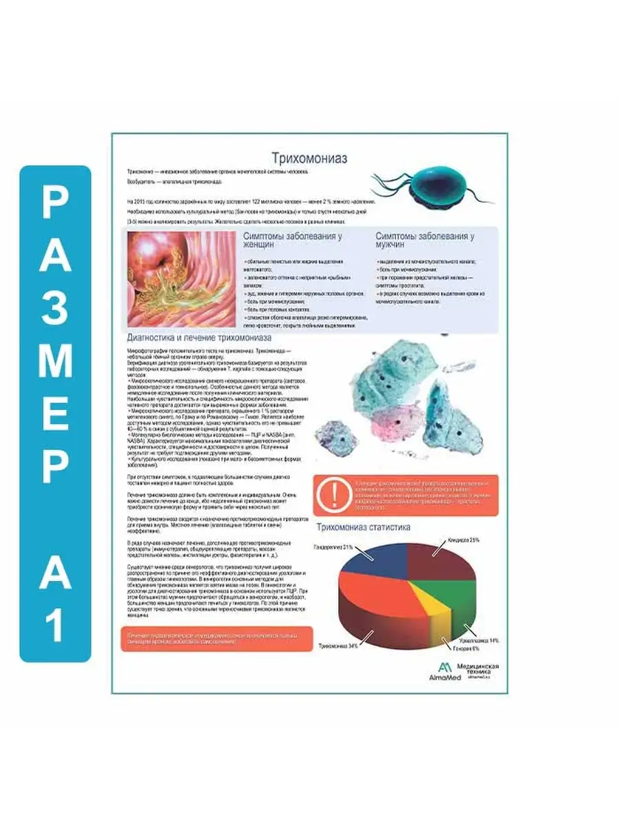 Трихомониаз медицинский плакат Плакаты купить по цене 1 053 ₽ в  интернет-магазине Wildberries | 63780271