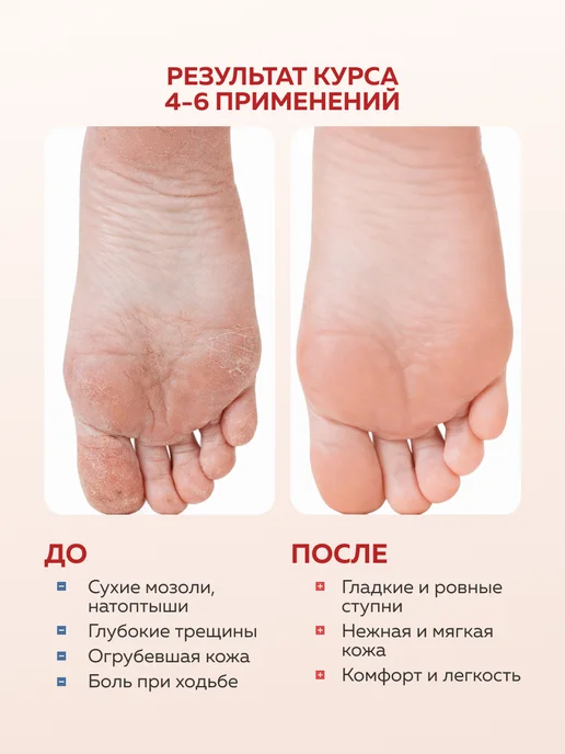 Fito cosmetic Кератолитик для пяток от натоптышей и трещин, вариант, фото 3