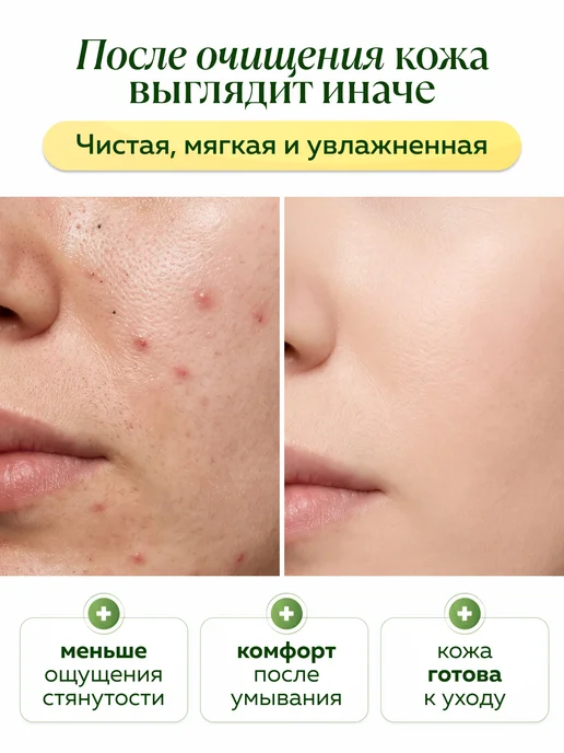 mi&ko Гидрофильное масло для лица от расширенных пор, 30 мл, фото 2