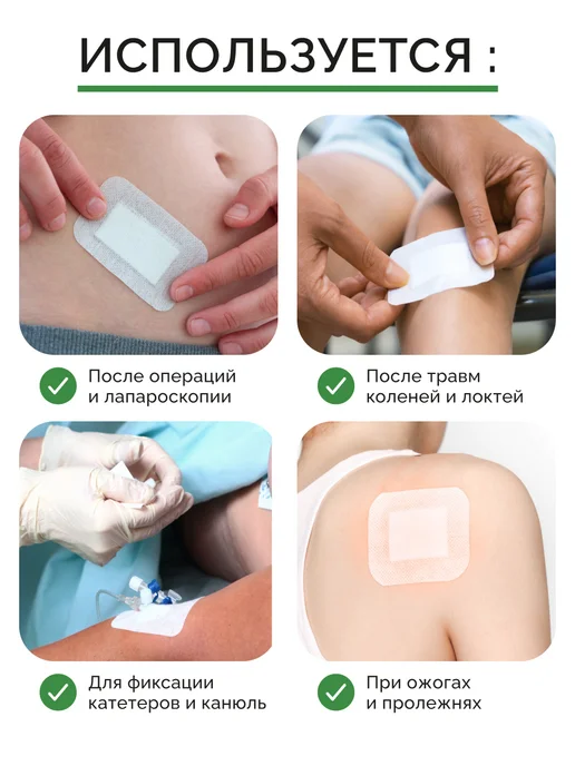 TENERIS Пластырь-повязка послеоперационный 8х10 см, 10 шт, 8x10 см, 10 шт, фото 4