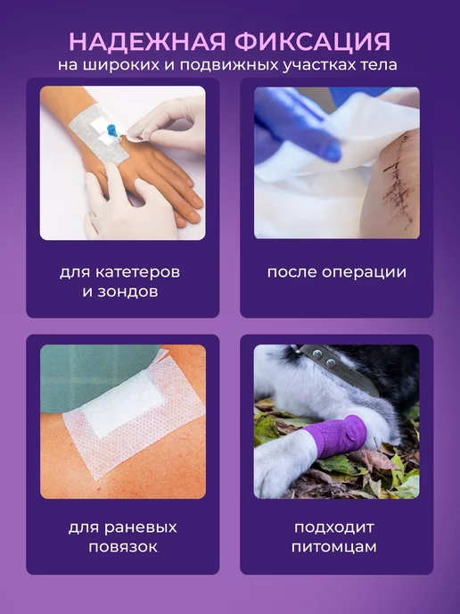 TENERIS Пластырь рулонный фиксирующий, 10 х 1000 см, 10x1000 см, фото 3