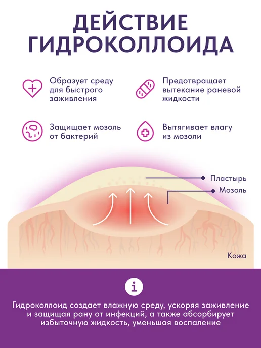 Foot Expert Пластыри от мозолей гидроколлоидные, набор 8 шт, 12 шт, фото 5