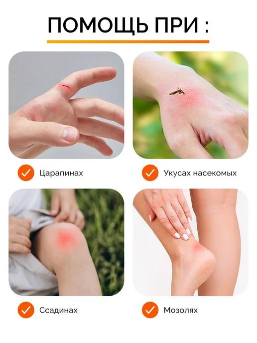 TENERIS Пластырь от мозолей смягчающий трение, 40 шт, 40 шт, фото 5