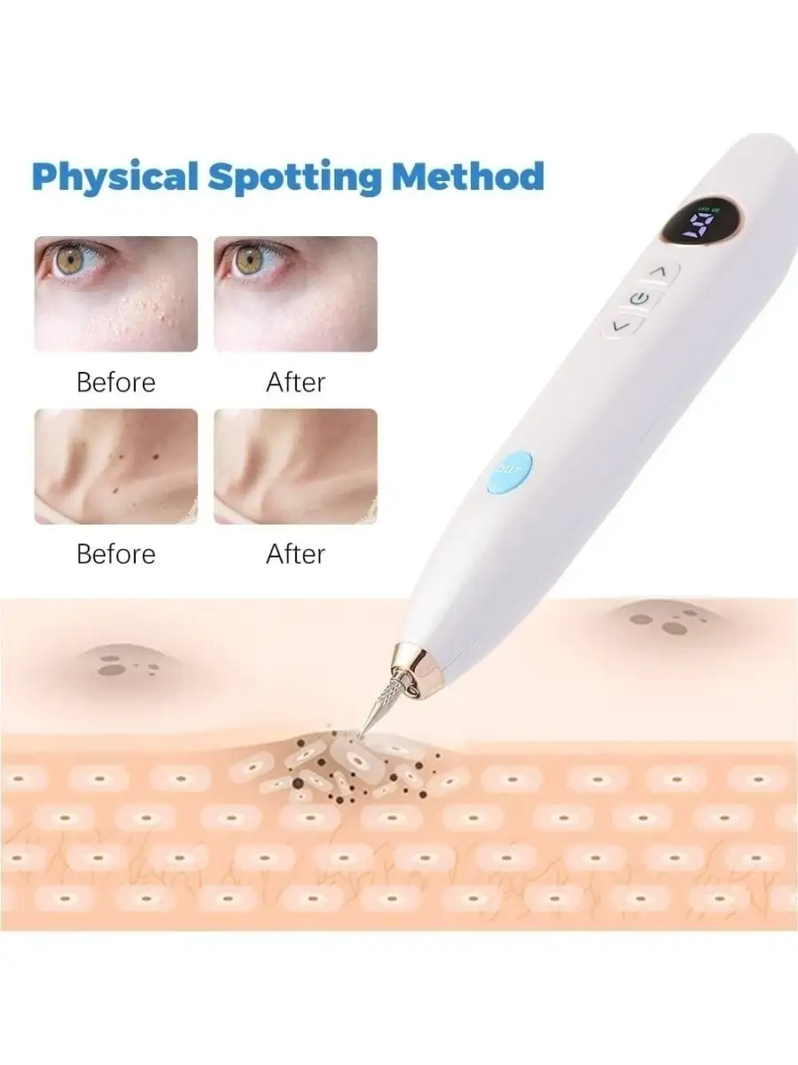 Коагулятор Лазерная ручка Beauty Mole Removal Pen 68834112 купить в  интернет-магазине Wildberries