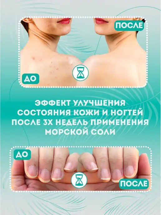 Dr. Stavi Соль для ванны 5 кг английская соль морская соль соль для ва…, 4 кг, фото 2