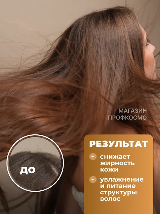 EPICA Кондиционер регулирующий работу сальных желёз 1000 мл, 1 л, фото 3