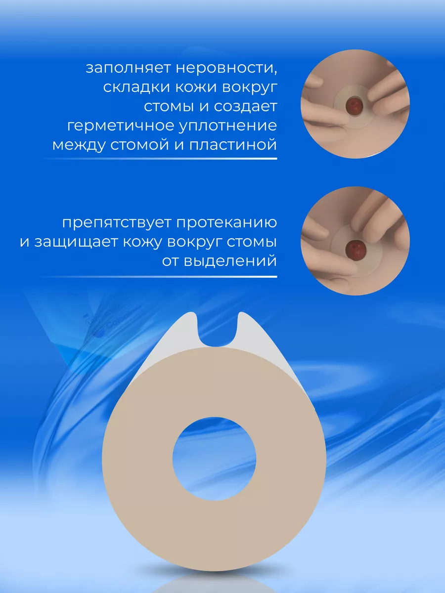 Защитное моделируемое кольцо Coloplast Brava, уход за стомой Coloplast  70792918 купить за 1 589 ₽ в интернет-магазине Wildberries