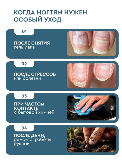 INKI Гель для удаления кутикулы профессиональный с мочевиной, вариант, фото 4