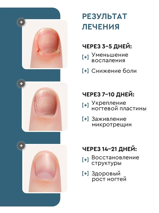 INKI Гель для удаления кутикулы профессиональный с мочевиной, вариант, фото 6