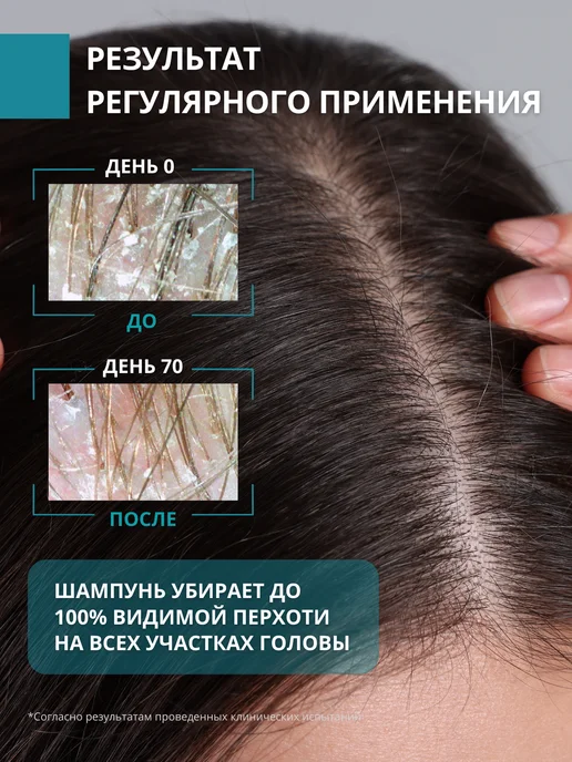 DR. MARCUS HEILER Шампунь от перхоти и зуда для восстановления микробиома, 250 мл, фото 2