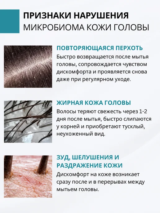 DR. MARCUS HEILER Шампунь от перхоти и зуда для восстановления микробиома, 250 мл, фото 7